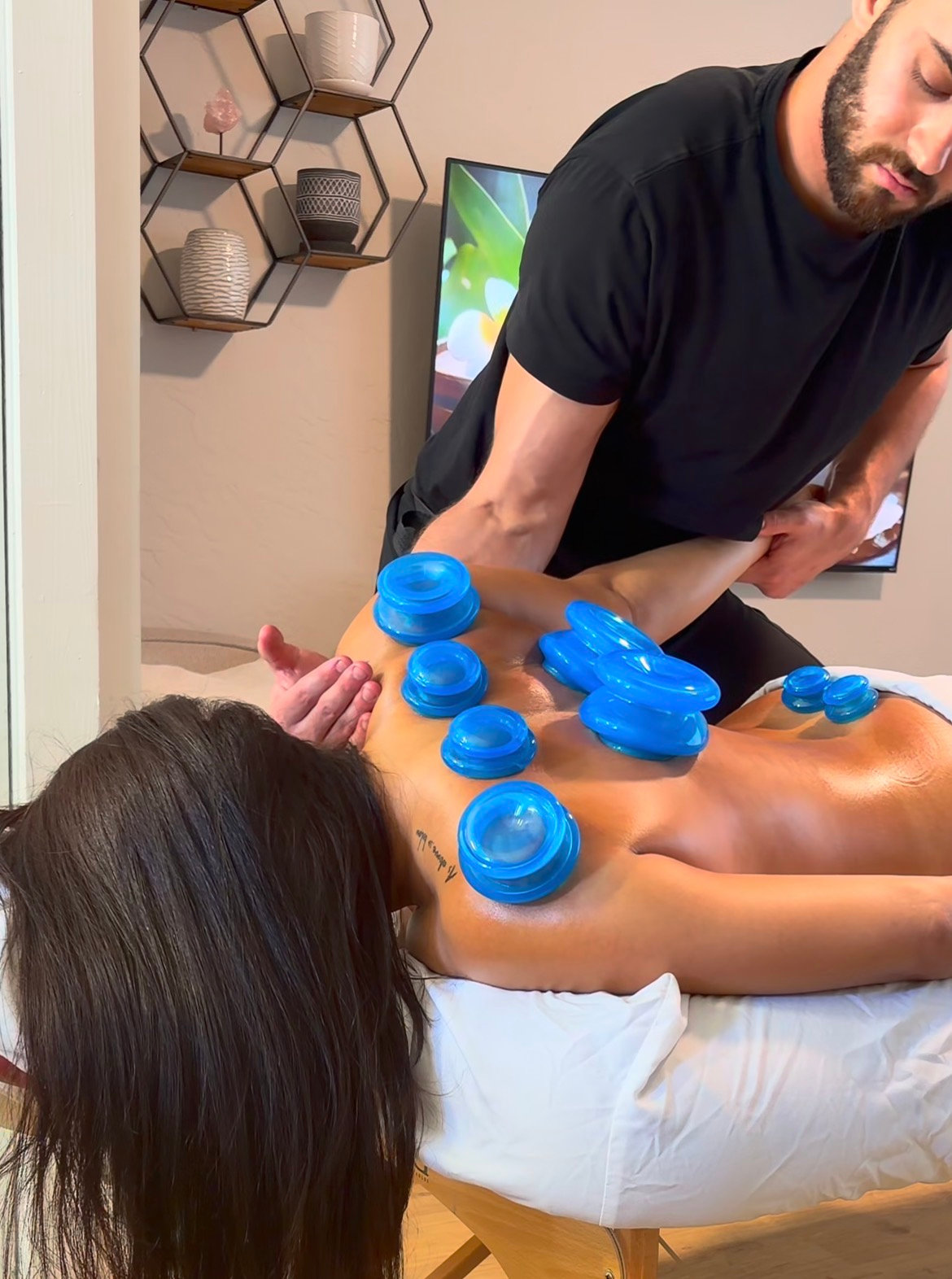 Cupping therapy with silicone cups placed along the back